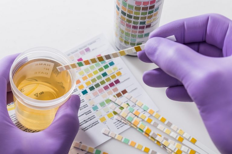 gloved hands uses drug testing strips in urine